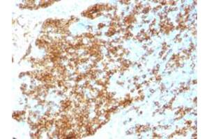 Immunohistochemical staining (Formalin-fixed paraffin-embedded sections) of human tonsil with CD45RB recombinant monoclonal antibody, clone PTPRC/1783R . (Recombinant CD45 anticorps)