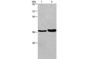 Western Blot analysis of Human testis tissue and transitional cell carcinoma of bladder tissue using FUT1 Polyclonal Antibody at dilution of 1:250 (FUT1 anticorps)