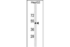 Western blot analysis in HepG2 cell line lysates (35ug/lane). (ST6GAL1 anticorps  (AA 178-206))