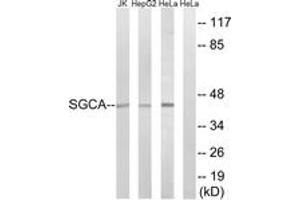 Western Blotting (WB) image for anti-Sarcoglycan, alpha (50kDa Dystrophin-Associated Glycoprotein) (SGCA) (AA 161-210) antibody (ABIN2890111) (SGCA anticorps  (AA 161-210))
