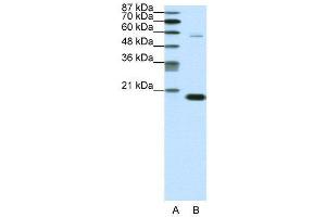 WB Suggested Anti-CBX3  Antibody Titration: 0. (CBX3 anticorps  (Middle Region))
