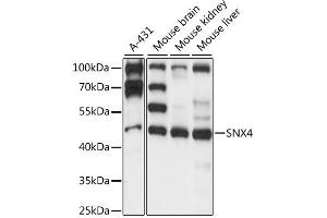Western blot analysis of extracts of various cell lines, using SNX4 antibody (ABIN6291214) at 1:1000 dilution. (Sorting Nexin 4 anticorps)