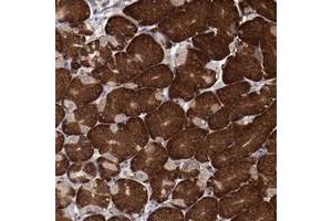 Immunohistochemical staining of human stomach with RPS4Y1 polyclonal antibody  shows strong cytoplasmic positivity in glandular cells at 1:50-1:200 dilution. (RPS4X anticorps)