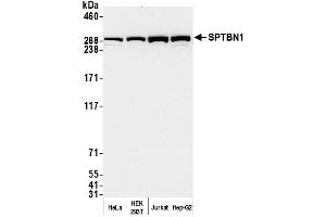Western Blotting (WB) image for anti-Spectrin Beta, Non-Erythrocytic 1 (SPTBN1) (AA 2100-2150) antibody (ABIN7454694) (SPTBN1 anticorps  (AA 2100-2150))