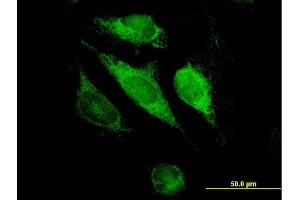 Immunofluorescence of purified MaxPab antibody to GSTK1 on HeLa cell. (GSTK1 anticorps  (AA 1-226))