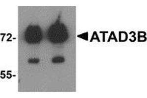 Western blot analysis of ATAD3B in human kidney tissue lysate with ATAD3B antibody at (left) 1 and (right) 2 μg/ml