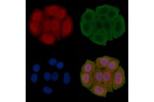 ABIN6266359 and ABIN6276704 staining Hela cells(30 min of UV treatment) by IF/ICC. (PRMT5 anticorps  (Internal Region))