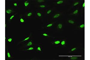 Immunofluorescence of purified MaxPab antibody to ESRRA on HeLa cell.