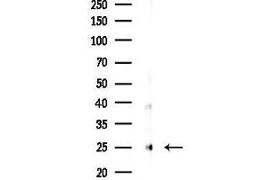 Western blot analysis of lysates from 293 cells(starvation,24h treatment), using FGF9 Antibody at 1/1000 dilution.