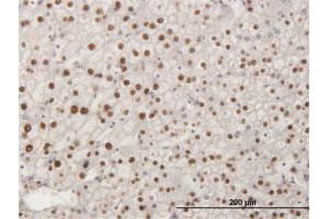 Immunoperoxidase of monoclonal antibody to SMAD6 on formalin-fixed paraffin-embedded human liver.