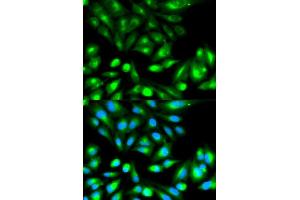 Immunofluorescence analysis of HeLa cell using RHOC antibody. (RHOC anticorps)
