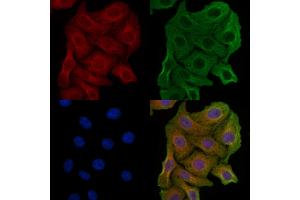 ABIN6257586 and ABIN6274837 staining Hela cells by IF/ICC. (AMPD2 anticorps  (N-Term))