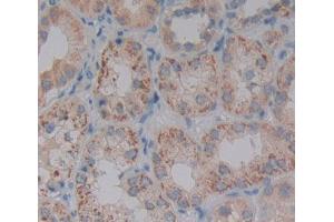 Used in DAB staining on fromalin fixed paraffin- embedded kidney tissue