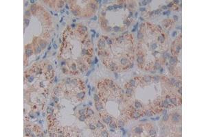 Used in DAB staining on fromalin fixed paraffin- embedded kidney tissue (PDP2 anticorps  (AA 1-186))