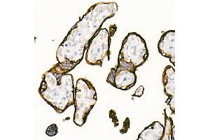 Immunohistochemistry of paraffin-embedded Human placenta using Placental alkaline phosphatase (PLAP) antibody (ABIN1682693, ABIN7101664, ABIN7101665 and ABIN7101666) at dilution of 1:1000 (40x lens). (PLAP anticorps)