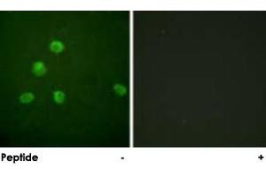Immunofluorescence analysis of HepG2 cells, using FOSB polyclonal antibody . (FOSB anticorps)