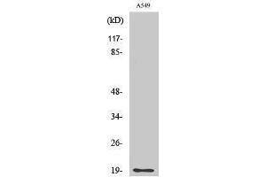 Western Blotting (WB) image for anti-CD3d Molecule, delta (CD3-TCR Complex) (CD3D) (Internal Region) antibody (ABIN3174265) (CD3D anticorps  (Internal Region))