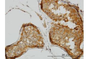 Immunoperoxidase of monoclonal antibody to CSDC2 on formalin-fixed paraffin-embedded human testis. (CSDC2 anticorps  (AA 1-153))