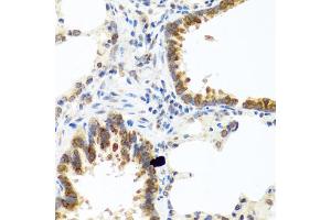 Immunohistochemistry of paraffin-embedded rat lung using C8orf4 antibody (ABIN5975014) at dilution of 1/100 (40x lens). (C8orf4 anticorps)