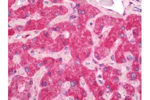 Human Liver: Formalin-Fixed, Paraffin-Embedded (FFPE)