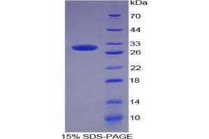 SDS-PAGE analysis of Rat SOD3 Protein. (SOD3 Protéine)