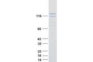 Validation with Western Blot