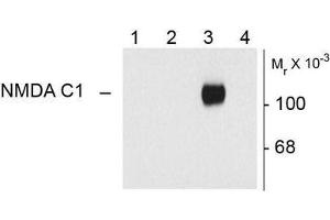 Image no. 1 for anti-NMDA Receptor 1 (NMDA R1) (Splice Variant C1) antibody (ABIN372675) (NMDA 1 Receptor anticorps  (Splice Variant C1))