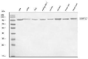 Western blot analysis of DNMT3B using anti-DNMT3B antibody (ABIN7601041).