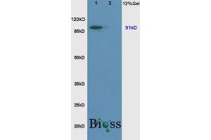 L1 rat brain, L2 rat liver lysates probed (ABIN669426) at 1:200 in 4 °C. (SLC9A1 anticorps  (AA 470-550))