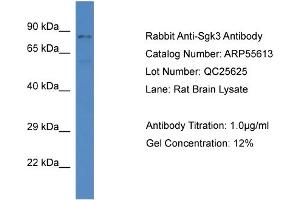 Western Blotting (WB) image for anti-serum/glucocorticoid Regulated Kinase Family, Member 3 (SGK3) (C-Term) antibody (ABIN2786286) (SGK3 anticorps  (C-Term))