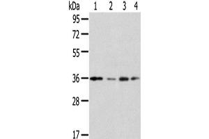 Western Blot analysis of Jurkat, A549, HepG2 and 293T cells using HOXD13 Polyclonal Antibody at dilution of 1/200 (Homeobox D13 anticorps)
