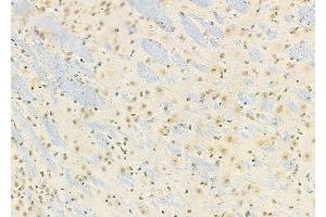 ABIN6258821 and ABIN6274163 at 1/100 staining Mouse brain tissue by IHC-P. (HKR1 anticorps  (Internal Region))
