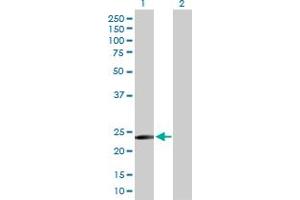 Western Blot analysis of TXNDC9 expression in transfected 293T cell line by TXNDC9 MaxPab polyclonal antibody. (TXNDC9 anticorps  (AA 1-188))