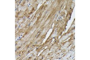 Immunohistochemistry of paraffin-embedded mouse heart using SOCS3 Rabbit pAb (ABIN3021099, ABIN3021100, ABIN3021101 and ABIN6213950) at dilution of 1:50 (40x lens).