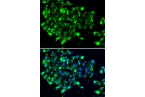Immunofluorescence analysis of MCF7 cell using NAT9 antibody. (NAT9 anticorps)