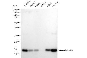 Western blotting analysis using Galectin 1 antibody (ABIN7799242). (Recombinant LGALS1/Galectin 1 anticorps)