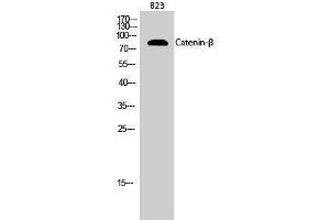 Western Blotting (WB) image for anti-Catenin, beta (CATNB) (Ser289) antibody (ABIN3183683) (beta Catenin anticorps  (Ser289))
