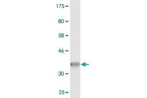 Western Blot detection against Immunogen (37. (SEC22B anticorps  (AA 1-110))