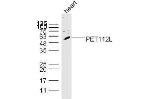 Mouse heart lysates probed with PET112L Polyclonal Antibody, unconjugated  at 1:300 overnight at 4°C followed by a conjugated secondary antibody at 1:10000 for 60 minutes at 37°C.