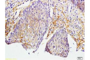 Formalin-fixed and paraffin embedded rat skin labeled with Anti-MIF Polyclonal Antibody, Unconjugated (ABIN736836) at 1:200 followed by conjugation to the secondary antibody and DAB staining.