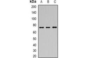 Western blot analysis of SAMHD1 expression in Hela (A), MCF7 (B), mouse spleen (C) whole cell lysates. (SAMHD1 anticorps)
