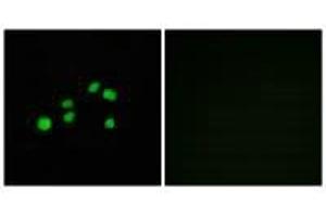 Immunofluorescence analysis of HepG2 cells, using Collagen XXIII α1 antibody.