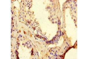 Immunohistochemistry of paraffin-embedded human testis tissue using ABIN7166671 at dilution of 1:100 (TDRD9 anticorps  (AA 286-585))