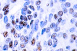 Image no. 2 for anti-Nuclear Factor of kappa Light Polypeptide Gene Enhancer in B-Cells 1 (NFKB1) antibody (ABIN271742)