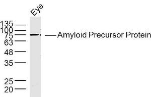Rat eye lysates probed with Amyloid Precursor Protein Antibody, Unconjugated  at 1:300 dilution and 4˚C overnight incubation. (APP anticorps  (AA 381-480))