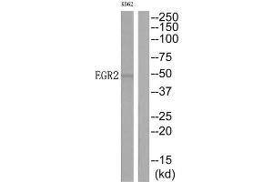 Western Blotting (WB) image for anti-Early Growth Response 2 (EGR2) (C-Term) antibody (ABIN1849150) (EGR2 anticorps  (C-Term))