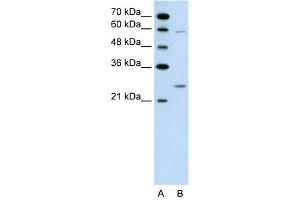 WB Suggested Anti-GAMT  Antibody Titration: 0. (GAMT anticorps  (N-Term))