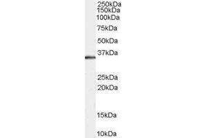 ABIN2560227 staining (0. (STUB1 anticorps  (C-Term))