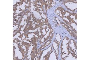 IHC analysis of WDR44 using anti-WDR44 antibody (ABIN7600394). (WDR44 anticorps  (AA 188-913))