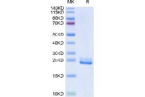 Human DLL3 (27-215) on Tris-Bis PAGE under reduced condition. (DLL3 Protein (AA 27-215) (His-DYKDDDDK Tag))